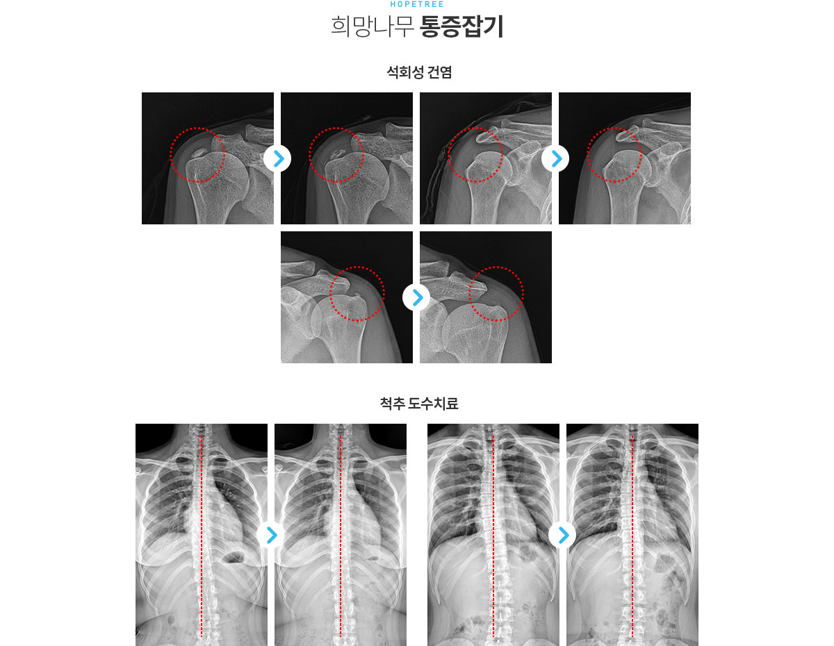 희망나무의 특별함